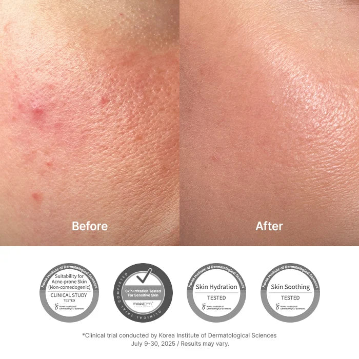 Dr.Althea 345 Relief Cream Post-Acne Face Moisturizer 50ml