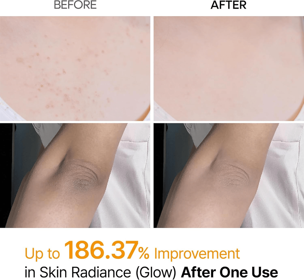 Dr.Melaxin Peel Shot Kojic Acid Turmeric Body Exfoliating Spray 200ml