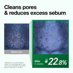 Anua Heartleaf Pore Control Cleansing Oil