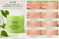 Anua Azelaic Acid 10% + Hyaluron Soothing Pad