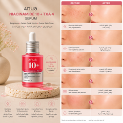 Anua Niacinamide 10% + TXA 4% Dark Spot Correcting Serum