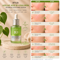 Anua Azelaic Acid 10 Hyaluron Redness Soothing Serum