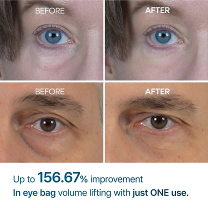 Dr.Melaxin Eyephalt Eyebag Cream Under Eye Firming Eye Cream 10ml